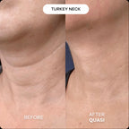 Collagen Neck Mask
