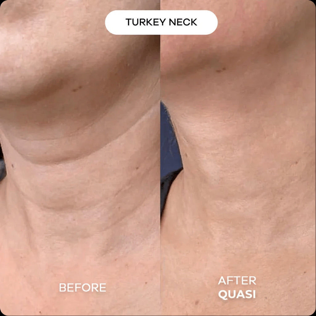 Collagen Neck Mask