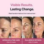Collagen Mask Bundle