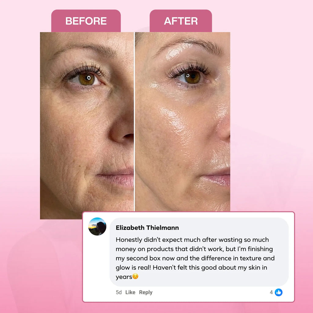 Collagen Mask Bundle
