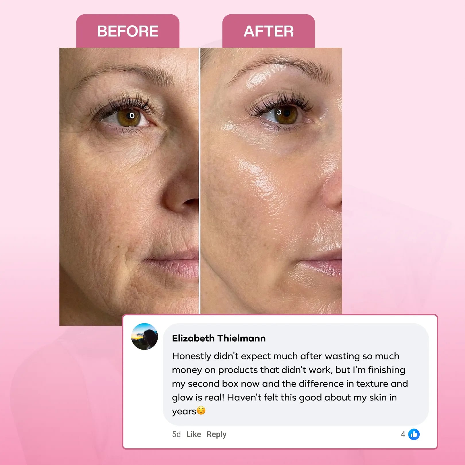 Collagen Mask Bundle